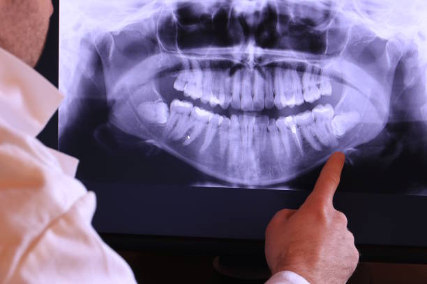 Best Emergency Dental Care for Broken or Chipped Teeth in Sparks, NV