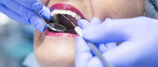 Best Emergency Treatment for Dental Infections or Abscesses in Sparks, NV